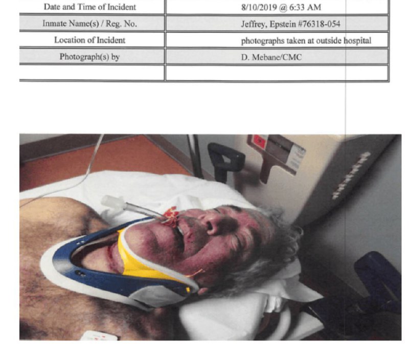 Опубликованы фотографии Эпштейна после смерти