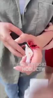 Житель Карачаево-Черкесии сломал бывшей жене позвоночник и украл имущество