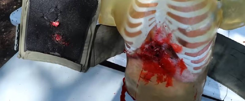 Заброневые травмы: особенности диагностики и лечения