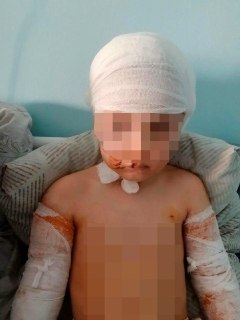 Собаки напали на пятилетнюю девочку в Диксоне: возбуждено дело о халатности