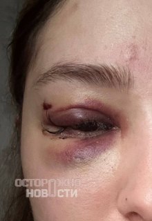 В Тюмени мужчина избил девушку в баре за ответ на оскорбления