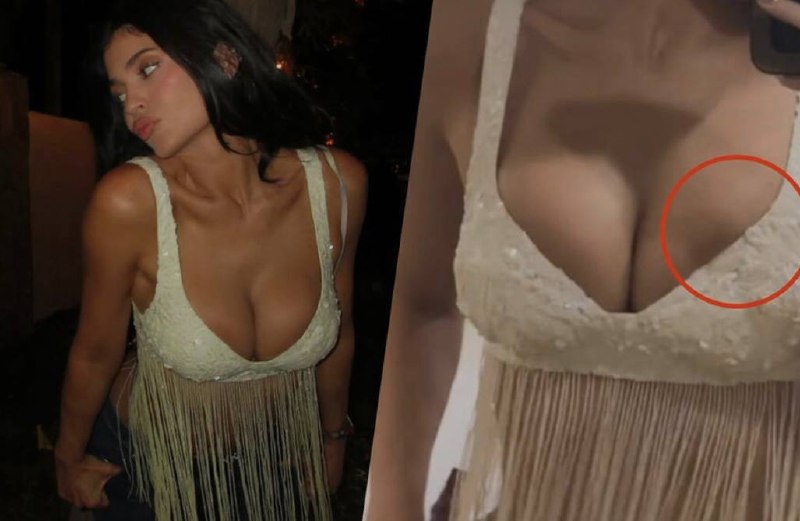 Грудь Кайли Дженнер встревожила подписчиков