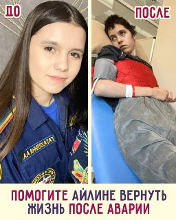 Сбор средств на реабилитацию студентки МЧС Айлины после тяжелого ДТП