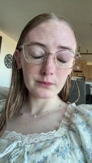 Американка ослепла из-за привычки принимать душ в контактных линзах