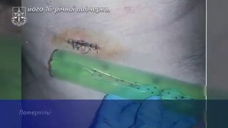 В Запорожье замначальника полиции в гражданском совершил нападение на мужчину в его же квартире
