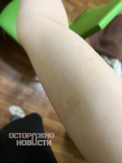 В Королёве девушка обвинила полицейского в избиении и угрозах сексуальным насилием