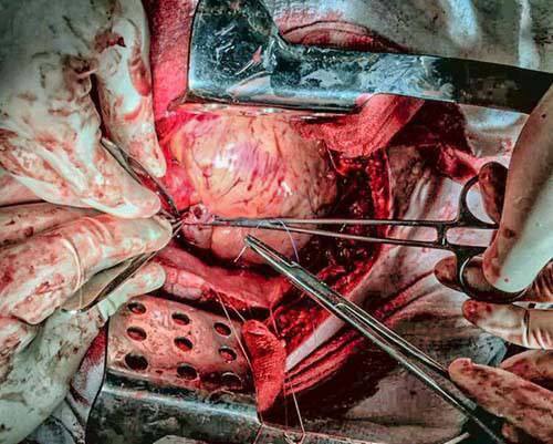 Особенности оказания помощи при ранениях сердца в полевых условиях