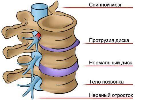 Особенности травм спинного мозга в зоне СВО: механизмы, диагностика и тактика лечения