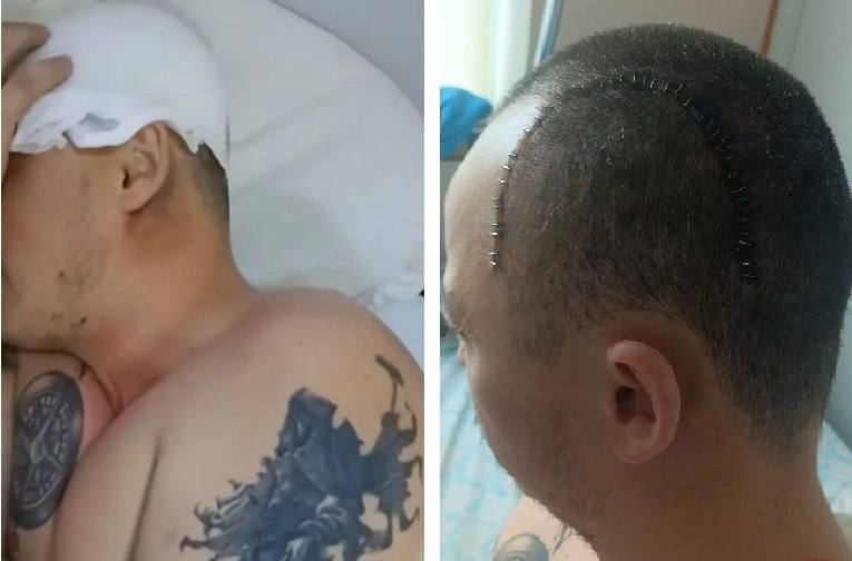 В Хмельницкой области ветерану проломили череп при нападении возле вокзала