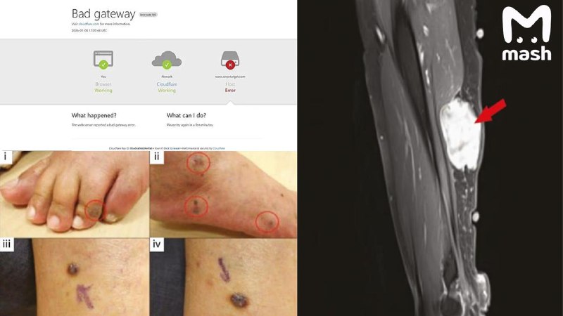 Связь вакцин Pfizer и Moderna с онкологией: исследование заблокировали после публикации